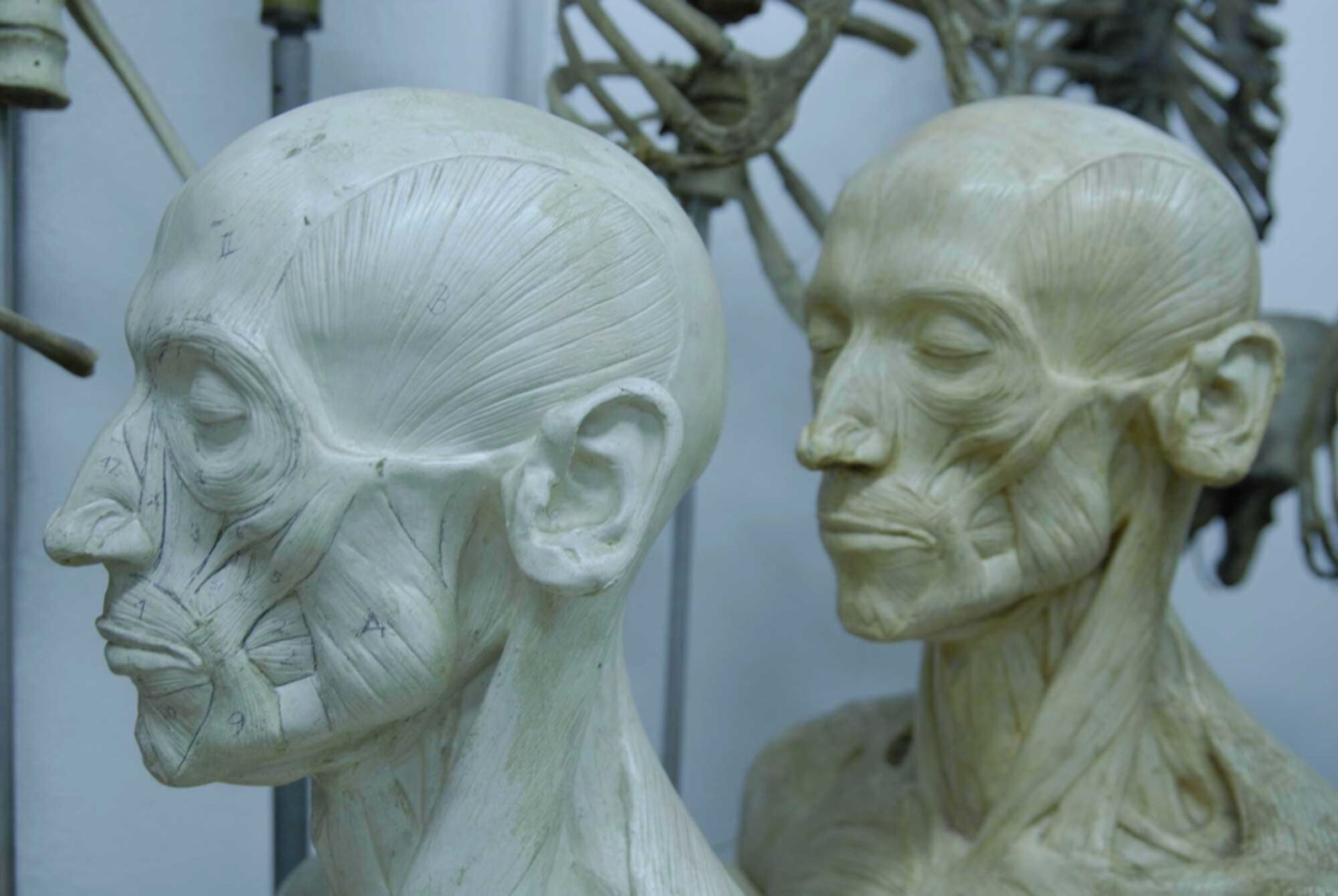 Muskelköpfe, Anatomische Sammlung