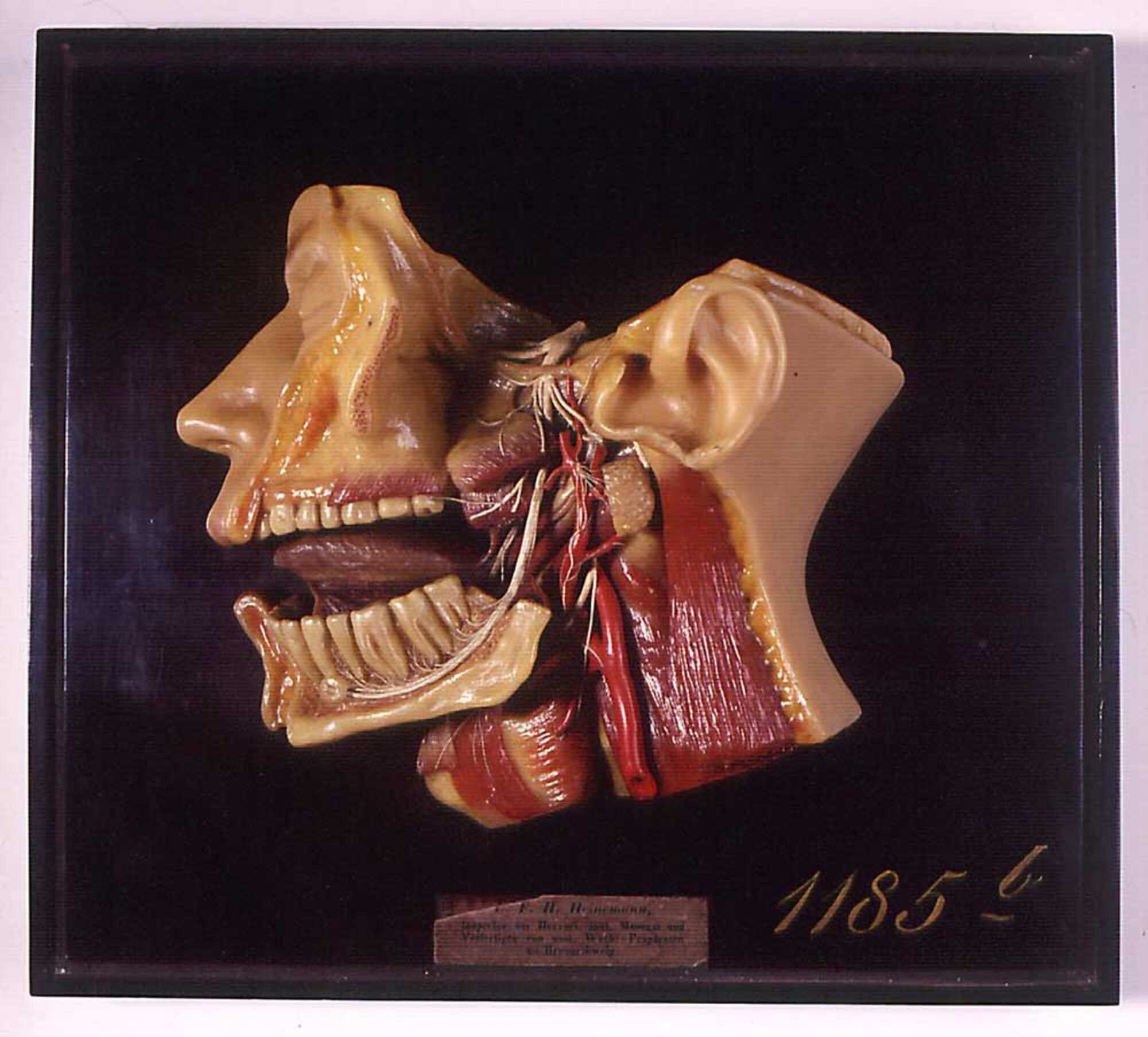 Anatomie der linken Gesichtshälfte / Kiefer und Rachenraum